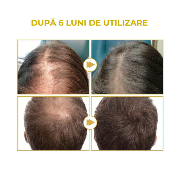 SER INAINTE-DUPA